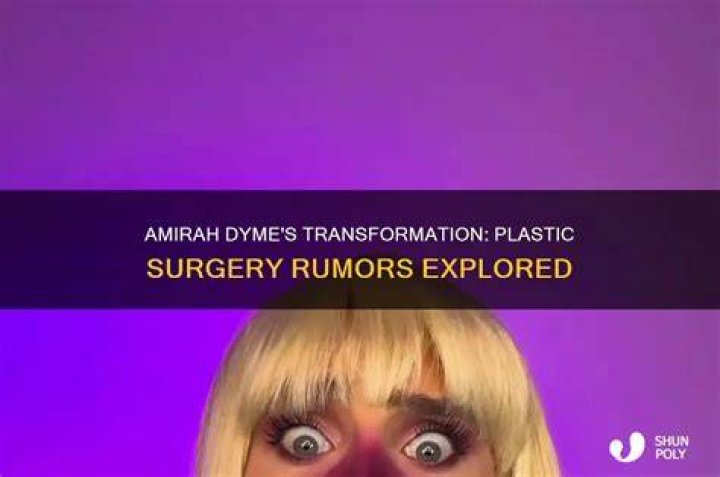 Unveiling The Journey Of Amirah Dyme: Pre-Surgery Insights